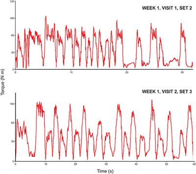 Eccentric Exercise Program Design: A Periodization Model for Rehabilitation Applications